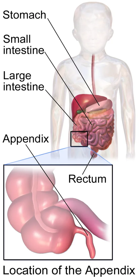 Location of the appendix in the lower right abdomen