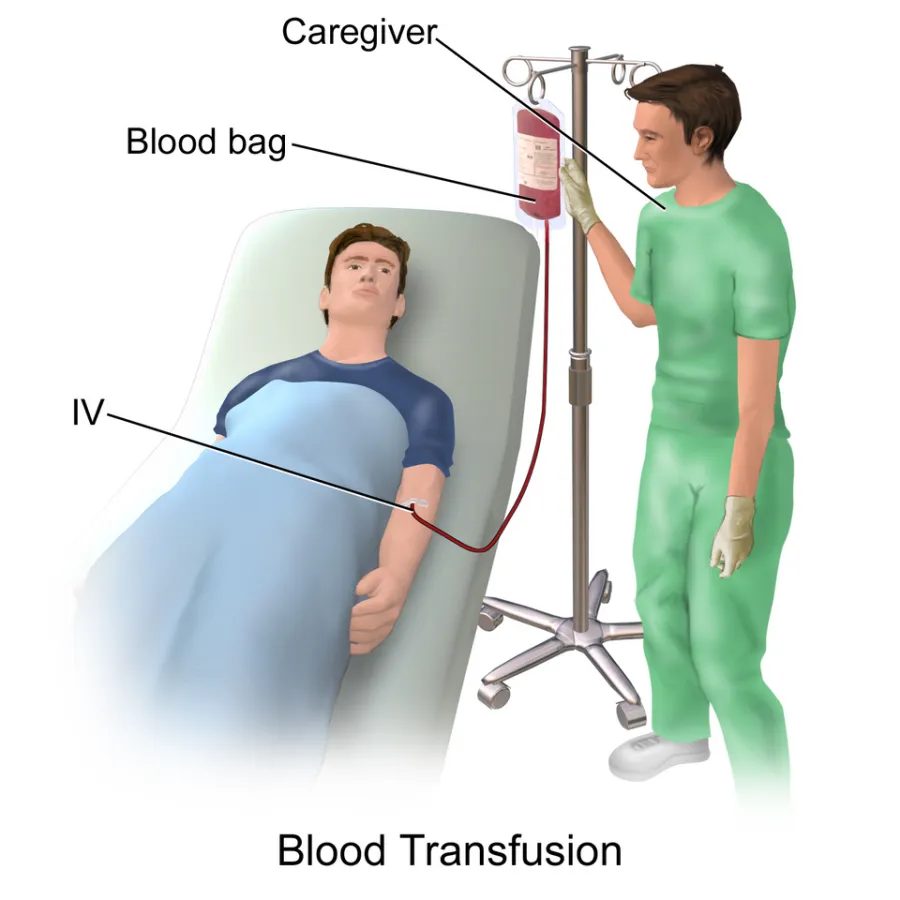 Blood Transfusion Reaction — medical illustration