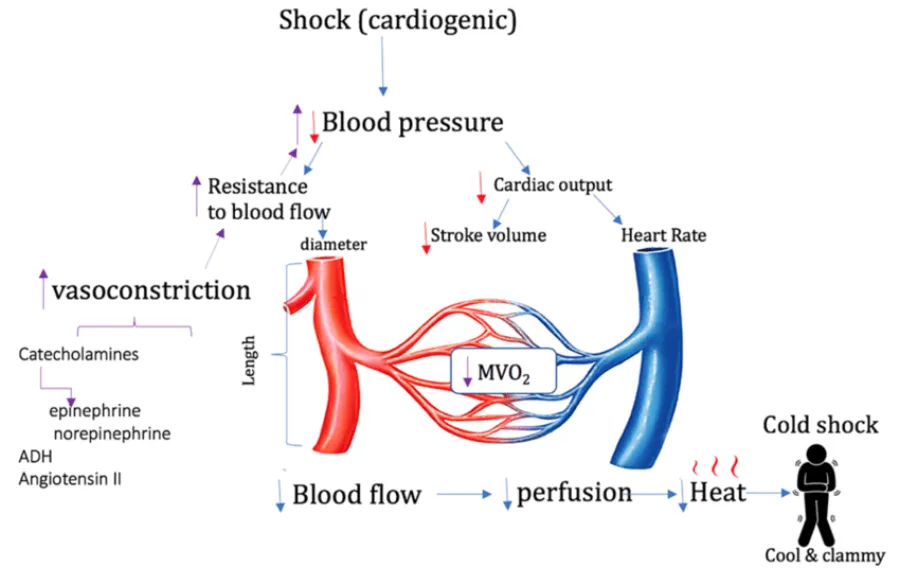 Cardiogenic Shock — medical illustration