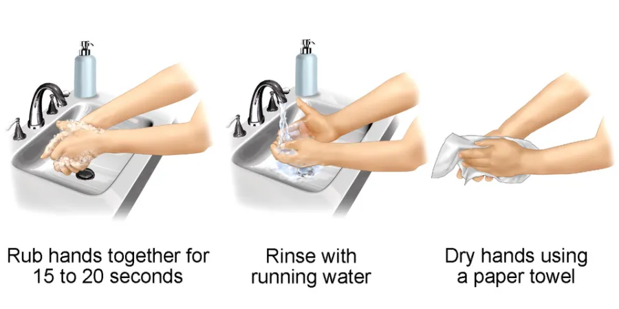 Hand Hygiene — medical illustration