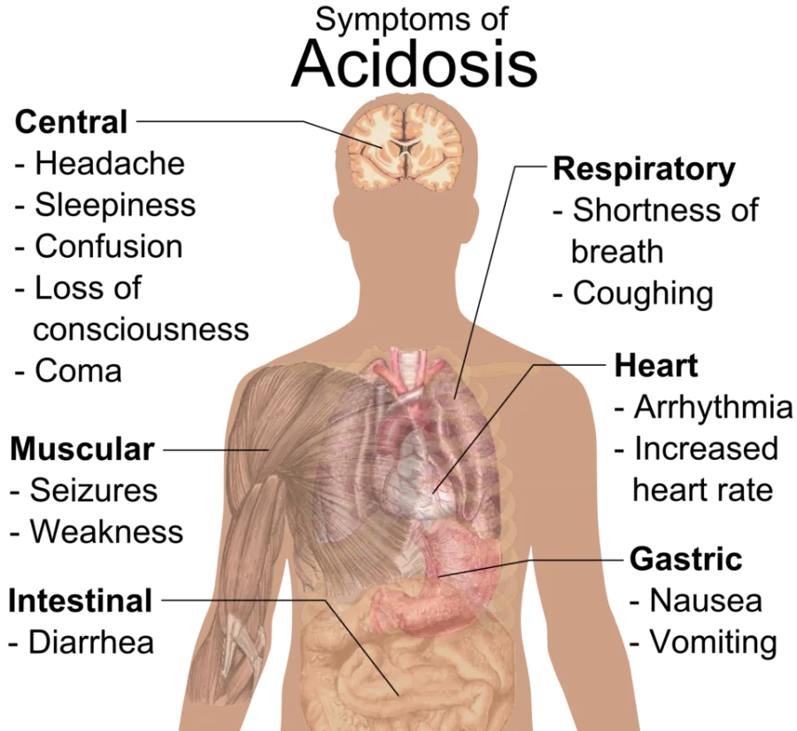 Metabolic Acidosis — medical illustration
