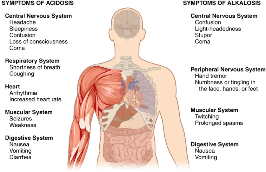 Metabolic Alkalosis — medical illustration