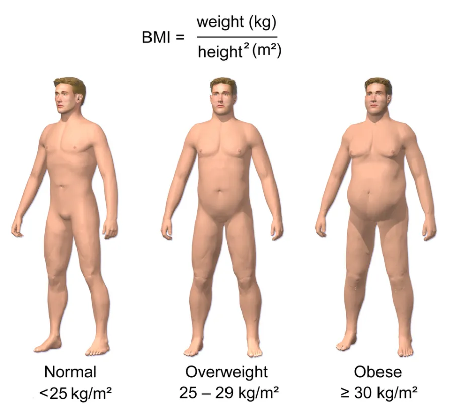 Obesity Management — medical illustration