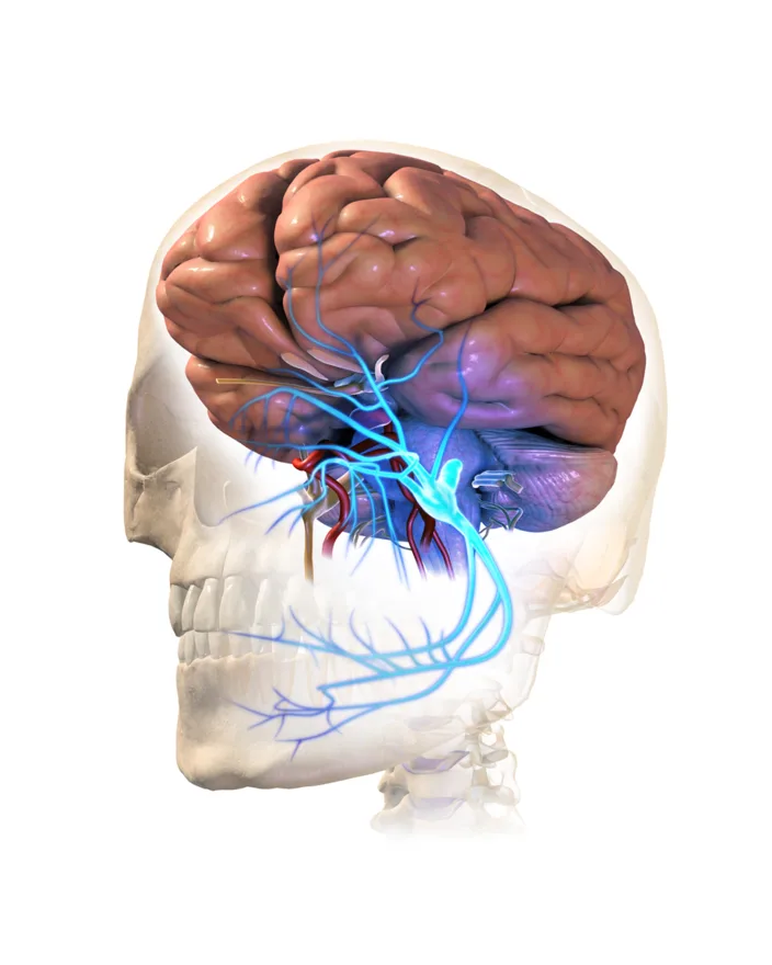 Trigeminal neuralgia: irritation of the trigeminal (fifth cranial) nerve